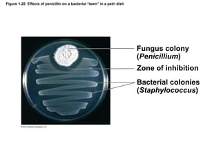 Figure 1.20 Effects of penicillin on a bacterial “lawn” in a petri dish
Fungus colony
(Penicillium)
Zone of inhibition
Bacterial colonies
(Staphylococcus)
 
