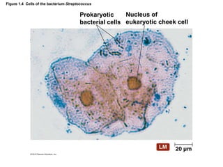 Figure 1.4 Cells of the bacterium Streptococcus
Nucleus of
eukaryotic cheek cell
Prokaryotic
bacterial cells
 