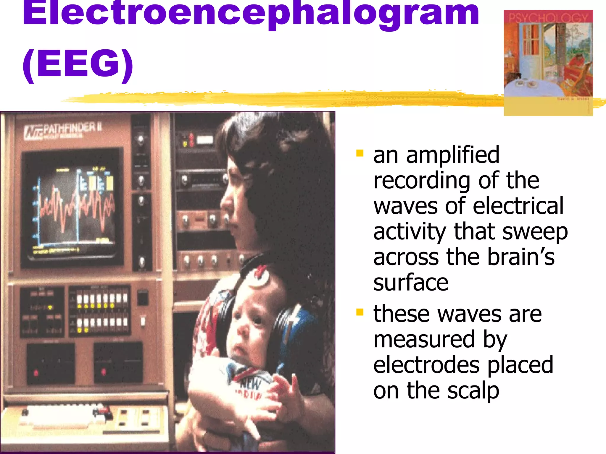 Electroencephalogram (EEG) an amplified recording of the waves of electrical activity that sweep across the brain’s surface these waves are measured by electrodes placed on the scalp 