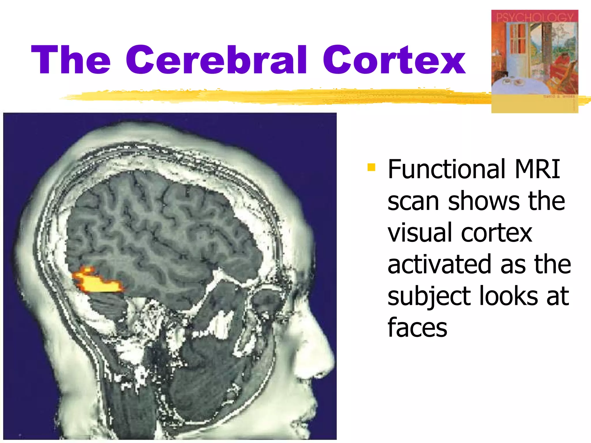 The Cerebral Cortex Functional MRI scan shows the visual cortex activated as the subject looks at faces 