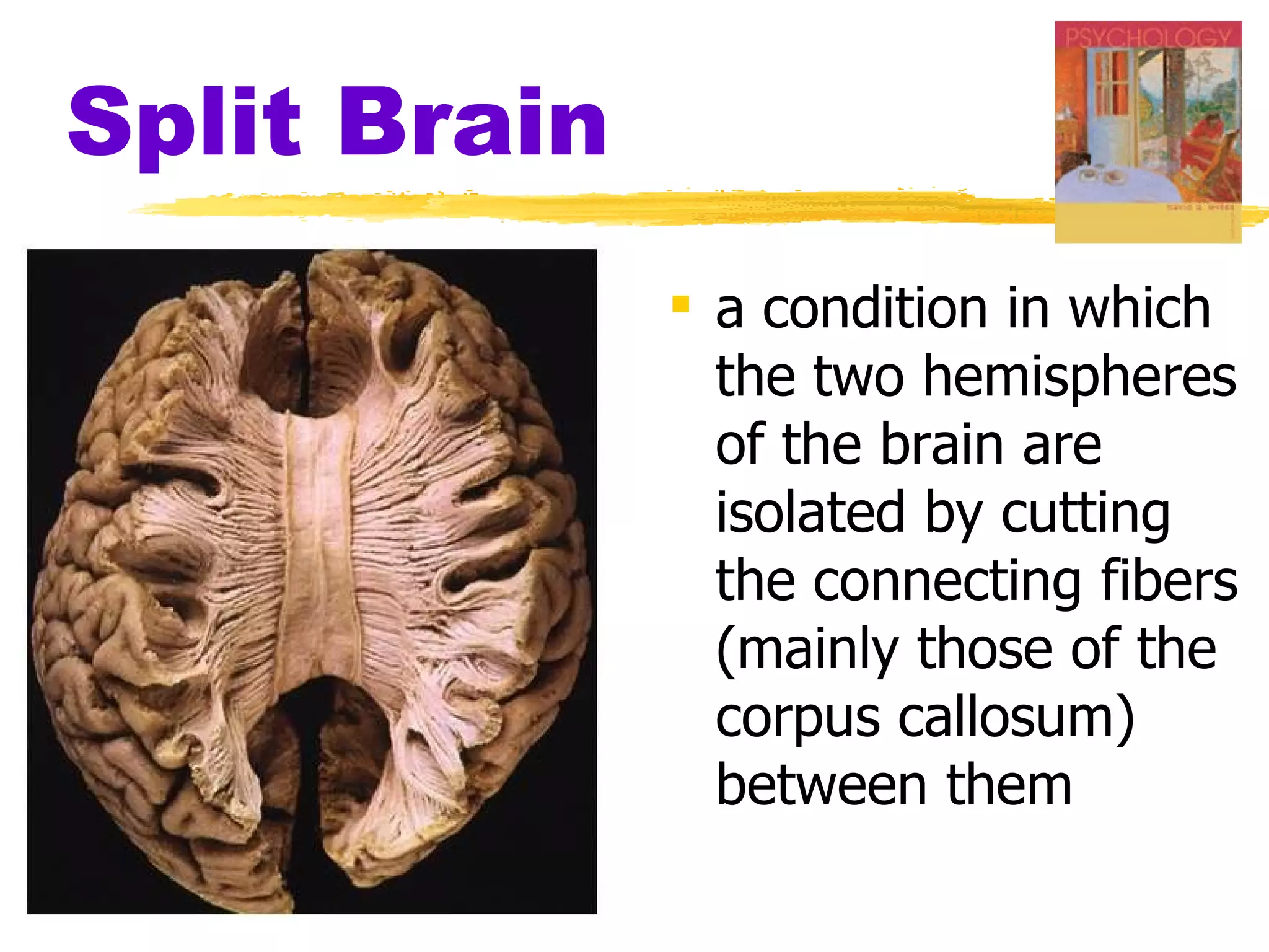 Split Brain a condition in which the two hemispheres of the brain are isolated by cutting the connecting fibers (mainly those of the corpus callosum) between them 