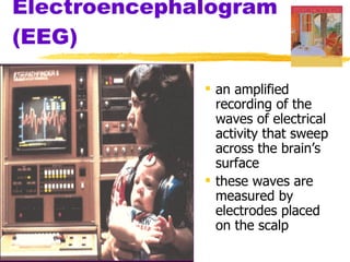 Electroencephalogram (EEG) an amplified recording of the waves of electrical activity that sweep across the brain’s surface these waves are measured by electrodes placed on the scalp 