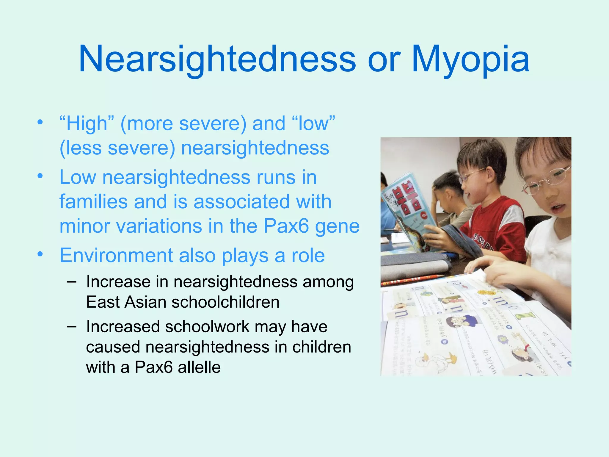Nearsightedness or Myopia
• “High” (more severe) and “low”
  (less severe) nearsightedness
• Low nearsightedness runs in
  families and is associated with
  minor variations in the Pax6 gene
• Environment also plays a role
   – Increase in nearsightedness among
     East Asian schoolchildren
   – Increased schoolwork may have
     caused nearsightedness in children
     with a Pax6 allelle
 