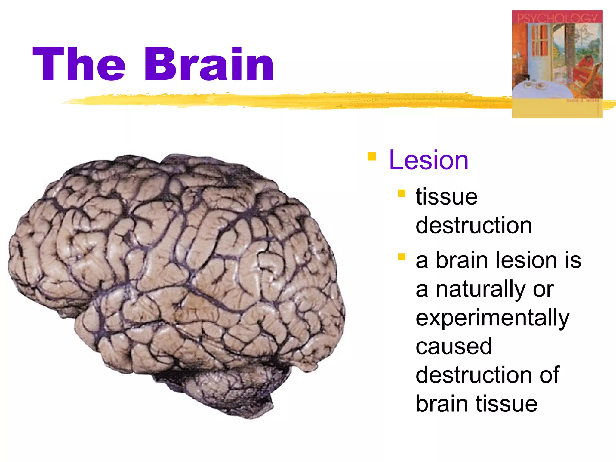 The Brain
             Lesion
               tissue
                destruction
               a brain lesion is
                a naturally or
                experimentally
                caused
                destruction of
                brain tissue
 
