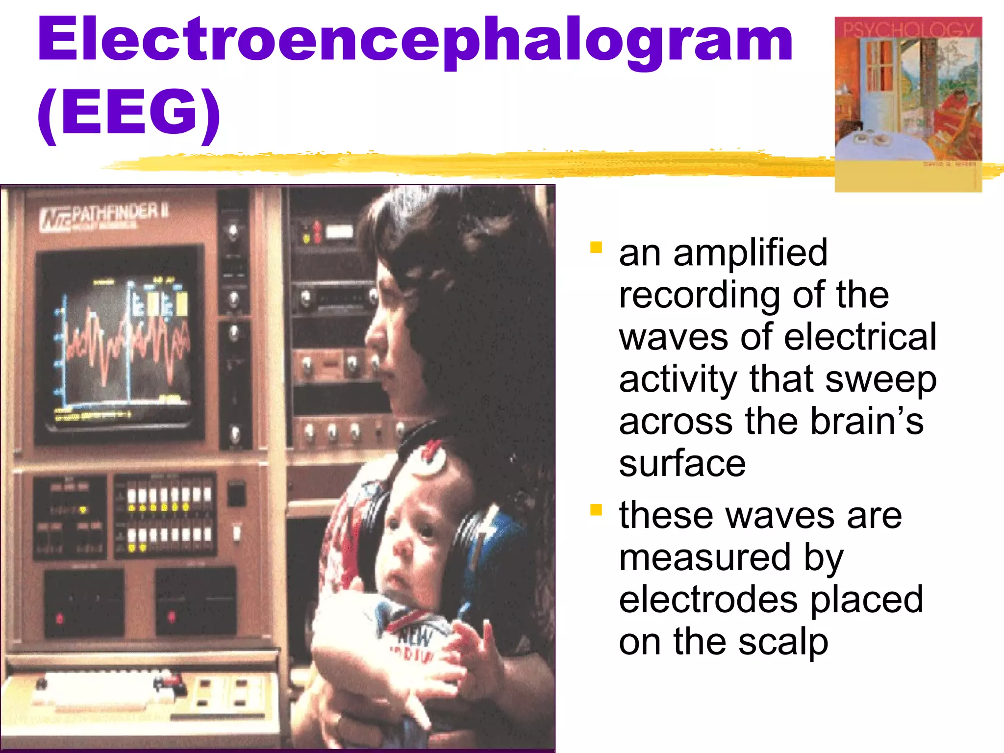 Electroencephalogram
(EEG)

               an amplified
                recording of the
                waves of electrical
                activity that sweep
                across the brain’s
                surface
               these waves are
                measured by
                electrodes placed
                on the scalp
 