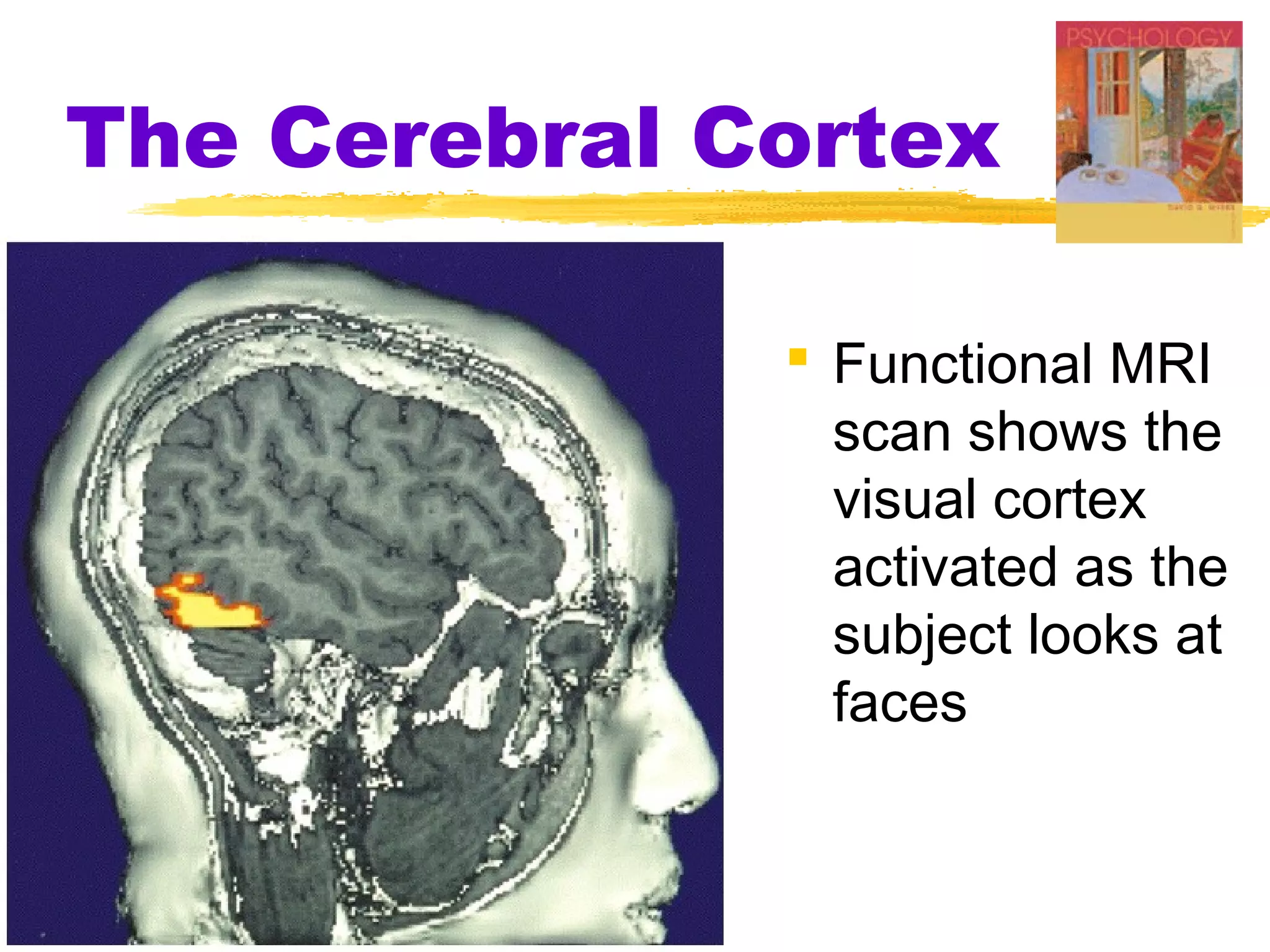 The Cerebral Cortex

               Functional MRI
                scan shows the
                visual cortex
                activated as the
                subject looks at
                faces
 