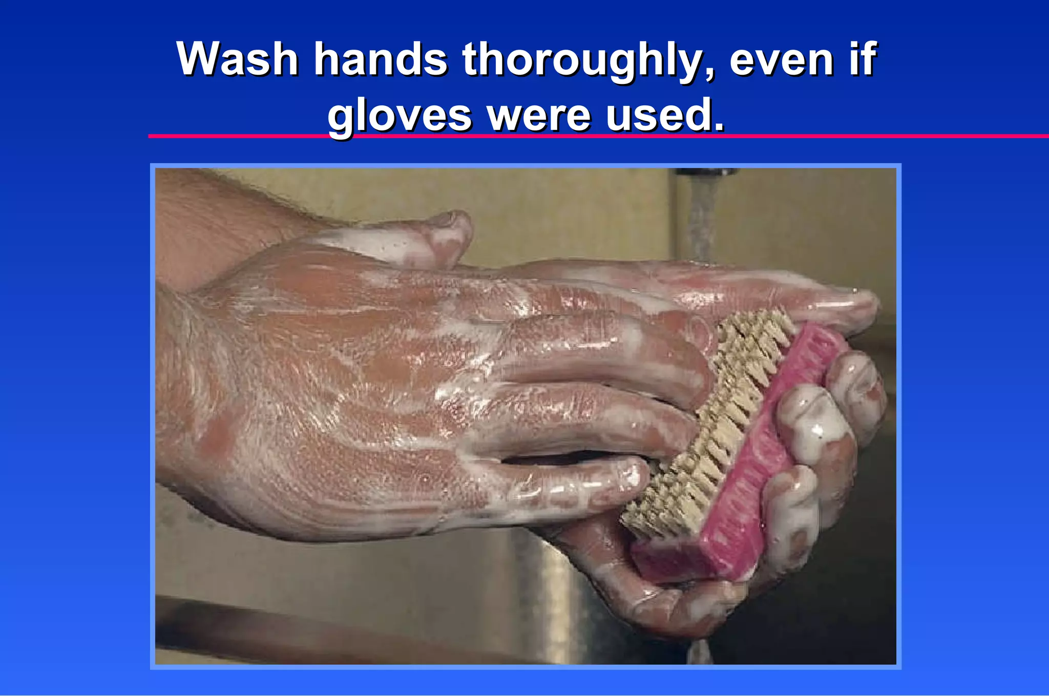 Wash hands thoroughly, even if gloves were used. 