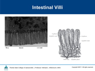 Copyright ©2011 All rights reserved.Florida State College of Jacksonville | Professor: Michael L. Whitchurch, MHS
Intestinal Villi
 