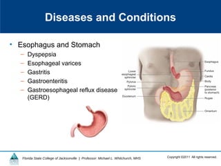 Copyright ©2011 All rights reserved.Florida State College of Jacksonville | Professor: Michael L. Whitchurch, MHS
Diseases and Conditions
• Esophagus and Stomach
– Dyspepsia
– Esophageal varices
– Gastritis
– Gastroenteritis
– Gastroesophageal reflux disease
(GERD)
 