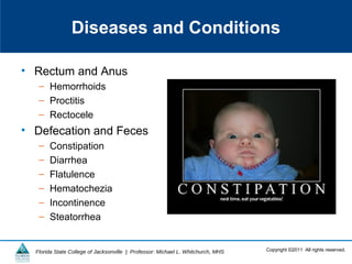 Copyright ©2011 All rights reserved.Florida State College of Jacksonville | Professor: Michael L. Whitchurch, MHS
Diseases and Conditions
• Rectum and Anus
– Hemorrhoids
– Proctitis
– Rectocele
• Defecation and Feces
– Constipation
– Diarrhea
– Flatulence
– Hematochezia
– Incontinence
– Steatorrhea
 