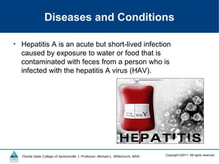 Copyright ©2011 All rights reserved.Florida State College of Jacksonville | Professor: Michael L. Whitchurch, MHS
Diseases and Conditions
• Hepatitis A is an acute but short-lived infection
caused by exposure to water or food that is
contaminated with feces from a person who is
infected with the hepatitis A virus (HAV).
 