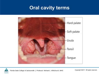 Copyright ©2011 All rights reserved.Florida State College of Jacksonville | Professor: Michael L. Whitchurch, MHS
Oral cavity terms
 