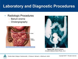Copyright ©2011 All rights reserved.Florida State College of Jacksonville | Professor: Michael L. Whitchurch, MHS
• Radiologic Procedures
– Barium enema
– Cholangiography
Laboratory and Diagnostic Procedures
Figure 3-24 Barium enema
(Custom Medical Stock Photo, Inc.)
 