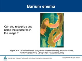Copyright ©2011 All rights reserved.Florida State College of Jacksonville | Professor: Michael L. Whitchurch, MHS
Barium enema
Figure 8.18 – Color enhanced X-ray of the colon taken during a barium enema.
(CNRI/Science Photo Library/Photo Researchers, Inc.)
Can you recognize and
name the structures in
the image ?
 