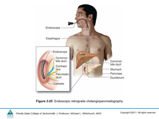 Copyright ©2011 All rights reserved.Florida State College of Jacksonville | Professor: Michael L. Whitchurch, MHS
Figure 3-25 Endoscopic retrograde cholangiopancreatography
 