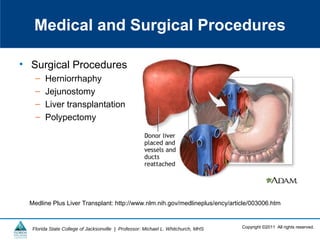 Copyright ©2011 All rights reserved.Florida State College of Jacksonville | Professor: Michael L. Whitchurch, MHS
Medical and Surgical Procedures
• Surgical Procedures
– Herniorrhaphy
– Jejunostomy
– Liver transplantation
– Polypectomy
Medline Plus Liver Transplant: http://www.nlm.nih.gov/medlineplus/ency/article/003006.htm
 