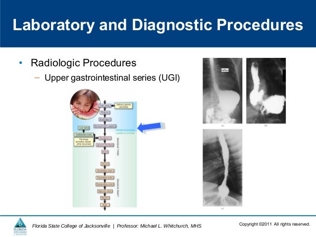 Digestive System Terminology