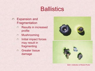 Ballistics
Expansion and
Fragmentation
Results in increased
profile
Mushrooming
Initial impact forces
may result in
fragmenting
Greater tissue
damage
Both: Collection of Robert Porter
 