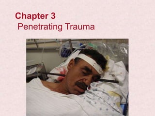 Chapter 3
Penetrating Trauma
 