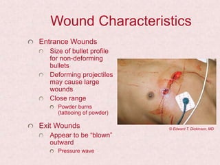 Wound Characteristics
Entrance Wounds
Size of bullet profile
for non-deforming
bullets
Deforming projectiles
may cause large
wounds
Close range
Powder burns
(tattooing of powder)
Exit Wounds
Appear to be “blown”
outward
Pressure wave
© Edward T. Dickinson, MD
 