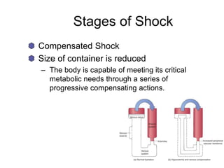 Stages of Shock
Compensated Shock
Size of container is reduced
– The body is capable of meeting its critical
metabolic needs through a series of
progressive compensating actions.
 