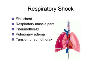 Respiratory Shock
Flail chest
Respiratory muscle paralysis
Pneumothorax
Pulmonary edema
Tension pneumothorax
 