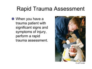 Rapid Trauma Assessment
When you have a
trauma patient with
significant signs and
symptoms of injury,
perform a rapid
trauma assessment.
© Jeff Forster
 