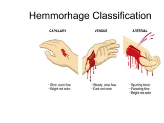 Hemmorhage Classification
 