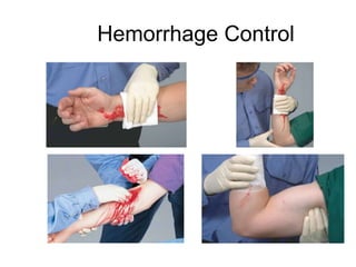 Hemorrhage Control
 