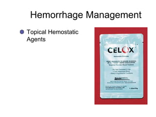 Hemorrhage Management
Topical Hemostatic
Agents
 