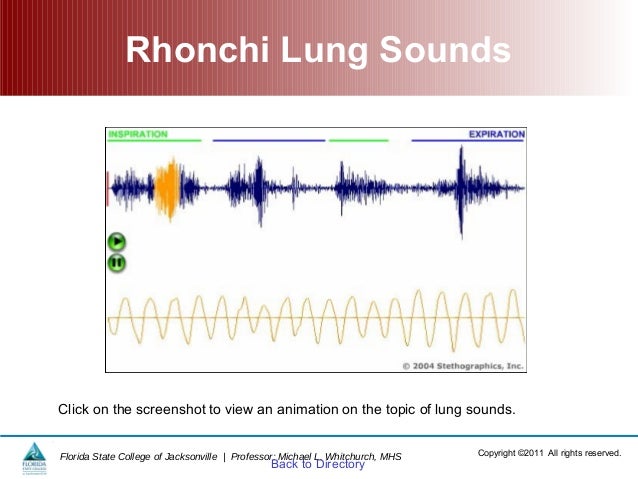 rhonchi lung sounds meaning