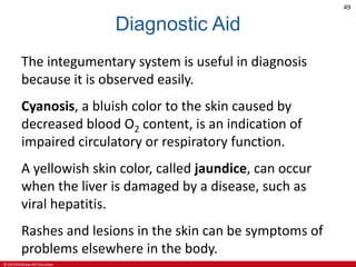 © 2019 McGraw-Hill Education
49
Diagnostic Aid
The integumentary system is useful in diagnosis
because it is observed easily.
Cyanosis, a bluish color to the skin caused by
decreased blood O2 content, is an indication of
impaired circulatory or respiratory function.
A yellowish skin color, called jaundice, can occur
when the liver is damaged by a disease, such as
viral hepatitis.
Rashes and lesions in the skin can be symptoms of
problems elsewhere in the body.
 
