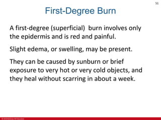© 2019 McGraw-Hill Education
51
First-Degree Burn
A first-degree (superficial) burn involves only
the epidermis and is red and painful.
Slight edema, or swelling, may be present.
They can be caused by sunburn or brief
exposure to very hot or very cold objects, and
they heal without scarring in about a week.
 