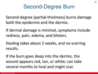 © 2019 McGraw-Hill Education
52
Second-Degree Burn
Second-degree (partial-thickness) burns damage
both the epidermis and the dermis.
If dermal damage is minimal, symptoms include
redness, pain, edema, and blisters.
Healing takes about 2 weeks, and no scarring
results.
If the burn goes deep into the dermis, the
wound appears red, tan, or white; can take
several months to heal and might scar.
 