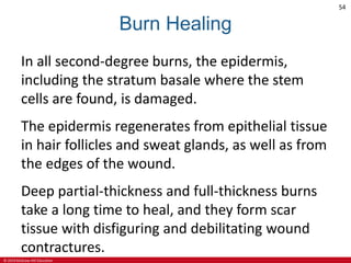 © 2019 McGraw-Hill Education
54
Burn Healing
In all second-degree burns, the epidermis,
including the stratum basale where the stem
cells are found, is damaged.
The epidermis regenerates from epithelial tissue
in hair follicles and sweat glands, as well as from
the edges of the wound.
Deep partial-thickness and full-thickness burns
take a long time to heal, and they form scar
tissue with disfiguring and debilitating wound
contractures.
 