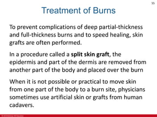 © 2019 McGraw-Hill Education
55
Treatment of Burns
To prevent complications of deep partial-thickness
and full-thickness burns and to speed healing, skin
grafts are often performed.
In a procedure called a split skin graft, the
epidermis and part of the dermis are removed from
another part of the body and placed over the burn
When it is not possible or practical to move skin
from one part of the body to a burn site, physicians
sometimes use artificial skin or grafts from human
cadavers.
 
