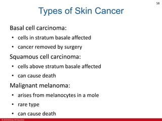 © 2019 McGraw-Hill Education
58
Types of Skin Cancer
Basal cell carcinoma:
• cells in stratum basale affected
• cancer removed by surgery
Squamous cell carcinoma:
• cells above stratum basale affected
• can cause death
Malignant melanoma:
• arises from melanocytes in a mole
• rare type
• can cause death
 