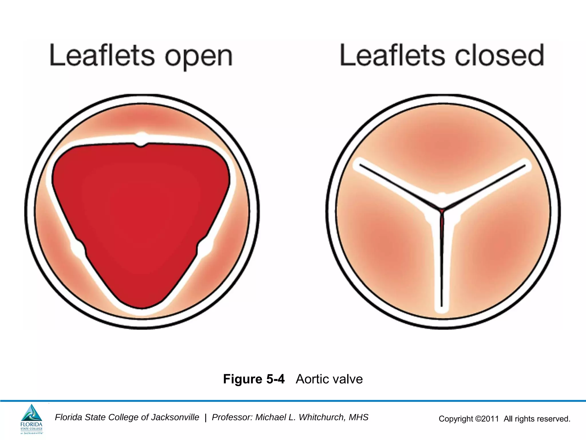 Copyright ©2011 All rights reserved.Florida State College of Jacksonville | Professor: Michael L. Whitchurch, MHS
Figure 5-4 Aortic valve
 