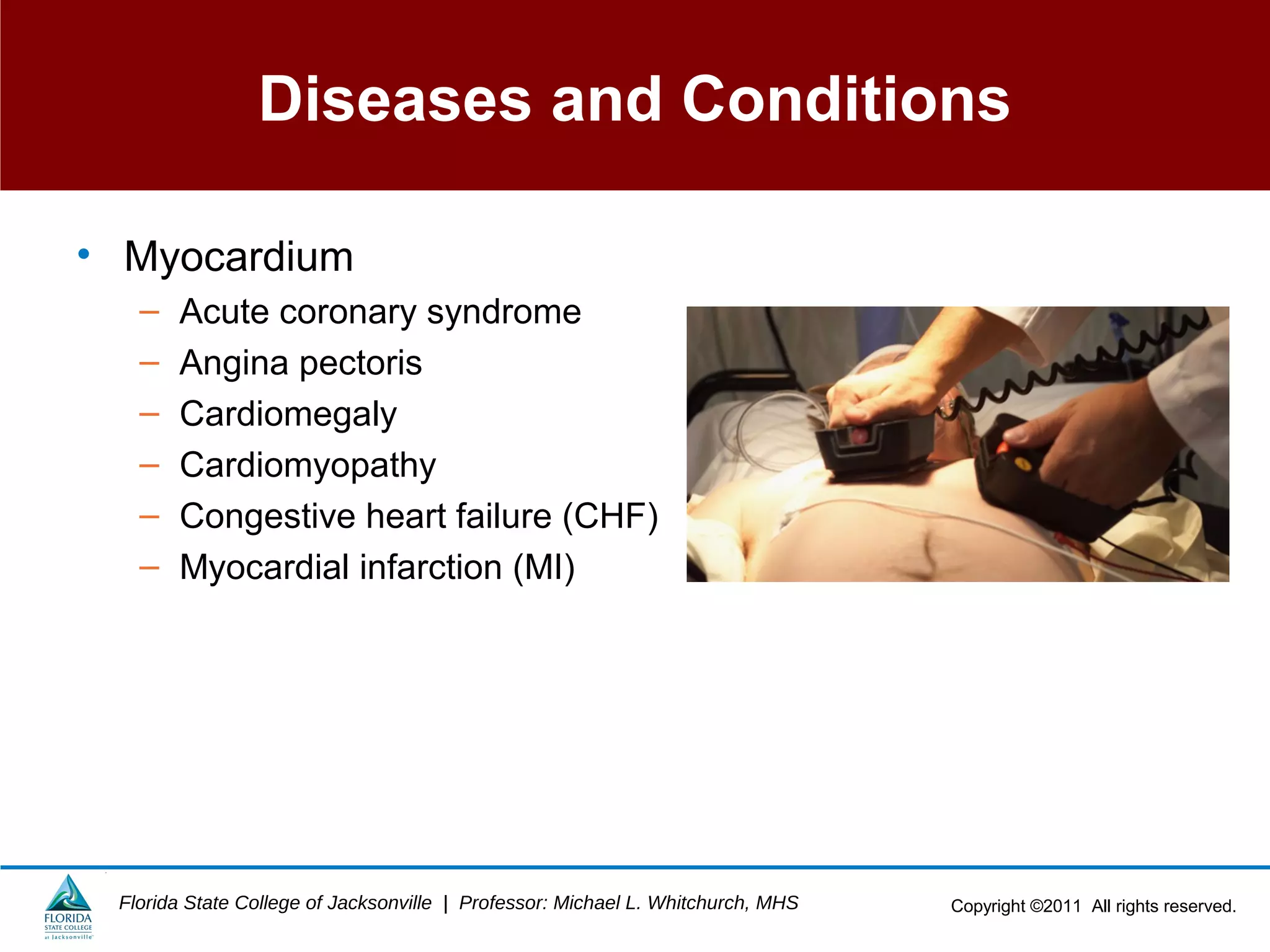Copyright ©2011 All rights reserved.Florida State College of Jacksonville | Professor: Michael L. Whitchurch, MHS
Diseases and Conditions
• Myocardium
– Acute coronary syndrome
– Angina pectoris
– Cardiomegaly
– Cardiomyopathy
– Congestive heart failure (CHF)
– Myocardial infarction (MI)
 