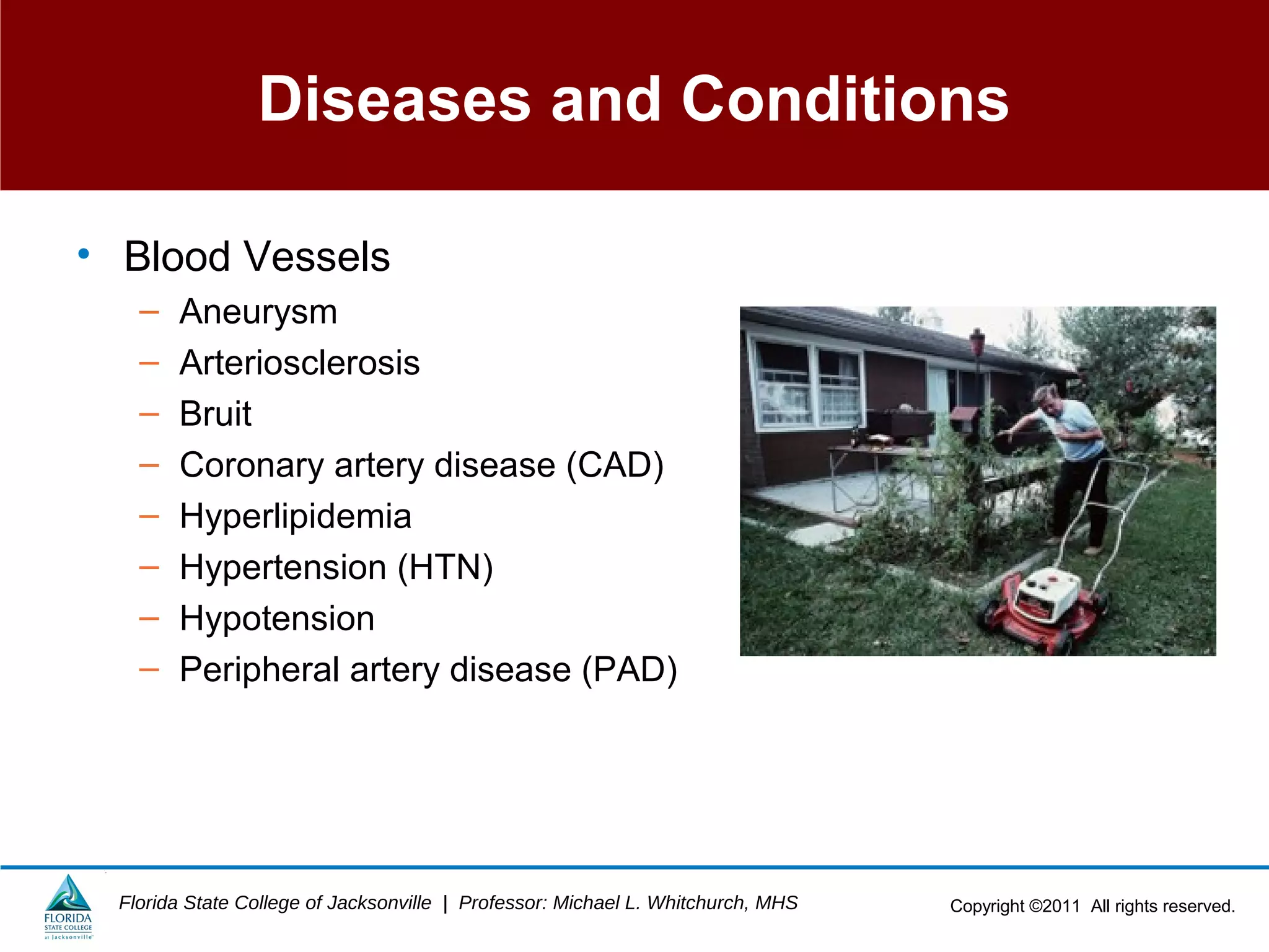 Copyright ©2011 All rights reserved.Florida State College of Jacksonville | Professor: Michael L. Whitchurch, MHS
Diseases and Conditions
• Blood Vessels
– Aneurysm
– Arteriosclerosis
– Bruit
– Coronary artery disease (CAD)
– Hyperlipidemia
– Hypertension (HTN)
– Hypotension
– Peripheral artery disease (PAD)
 