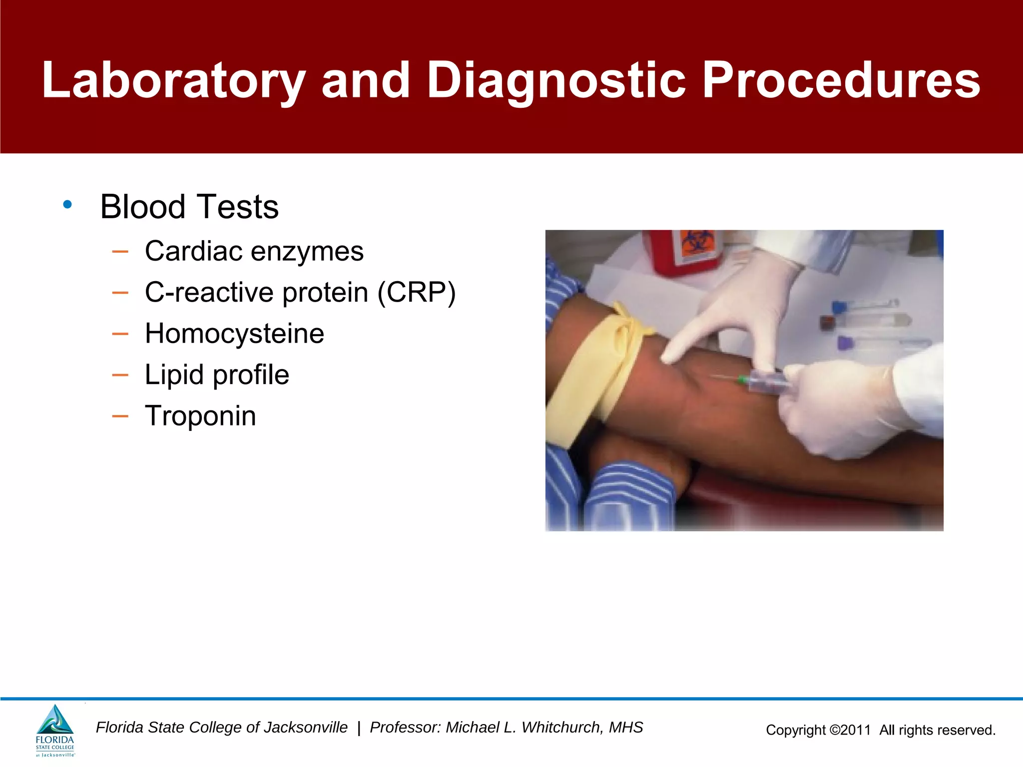Copyright ©2011 All rights reserved.Florida State College of Jacksonville | Professor: Michael L. Whitchurch, MHS
Laboratory and Diagnostic Procedures
• Blood Tests
– Cardiac enzymes
– C-reactive protein (CRP)
– Homocysteine
– Lipid profile
– Troponin
 