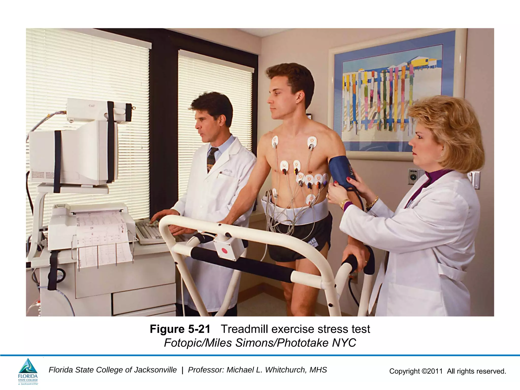 Copyright ©2011 All rights reserved.Florida State College of Jacksonville | Professor: Michael L. Whitchurch, MHS
Figure 5-21 Treadmill exercise stress test
Fotopic/Miles Simons/Phototake NYC
 