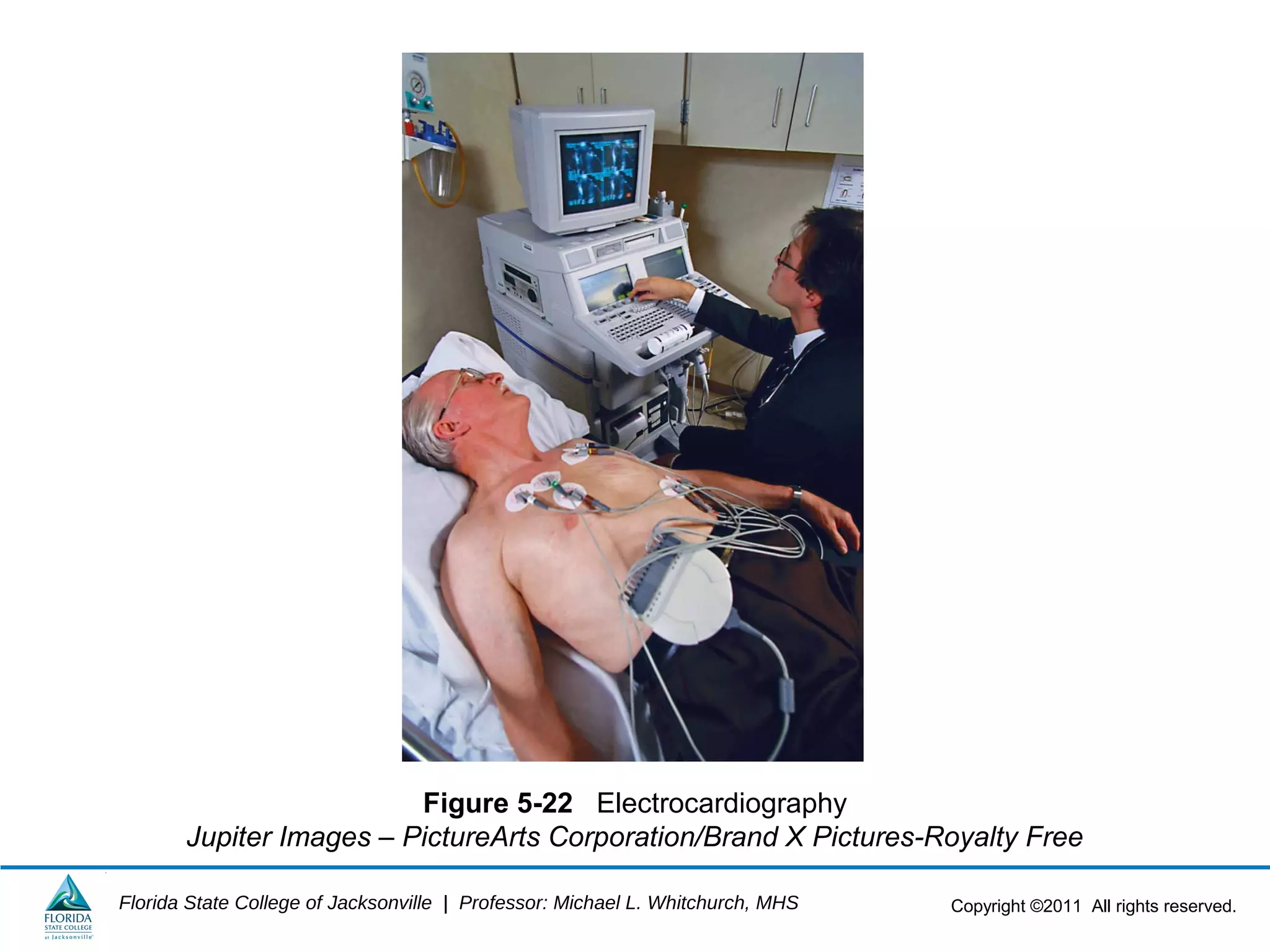 Copyright ©2011 All rights reserved.Florida State College of Jacksonville | Professor: Michael L. Whitchurch, MHS
Figure 5-22 Electrocardiography
Jupiter Images – PictureArts Corporation/Brand X Pictures-Royalty Free
 
