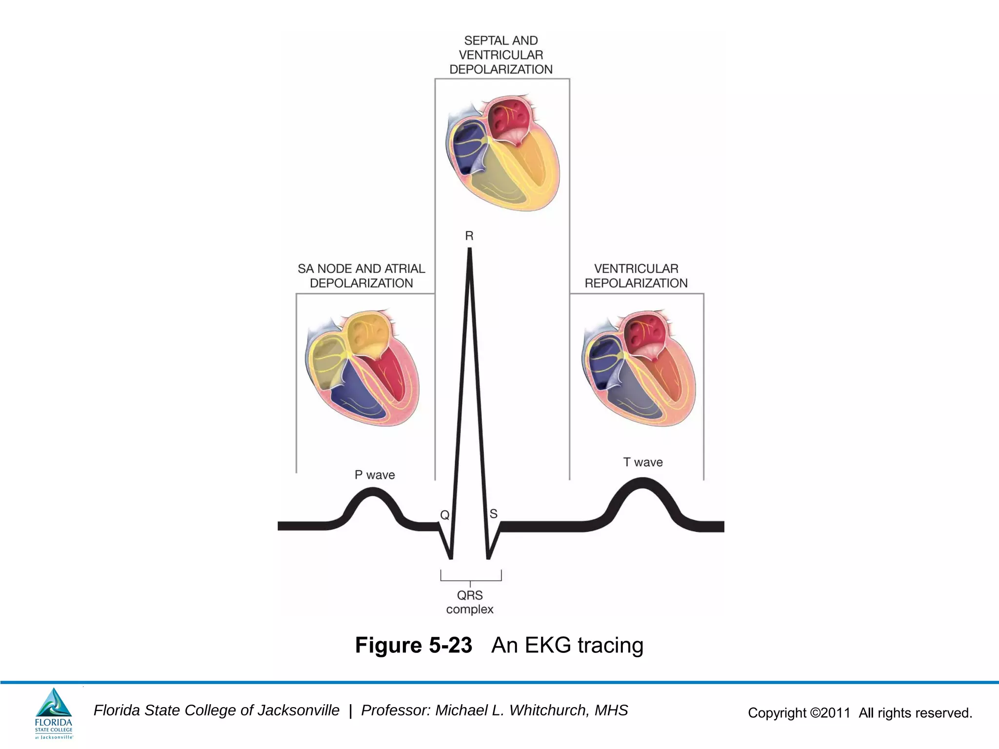 Copyright ©2011 All rights reserved.Florida State College of Jacksonville | Professor: Michael L. Whitchurch, MHS
Figure 5-23 An EKG tracing
 