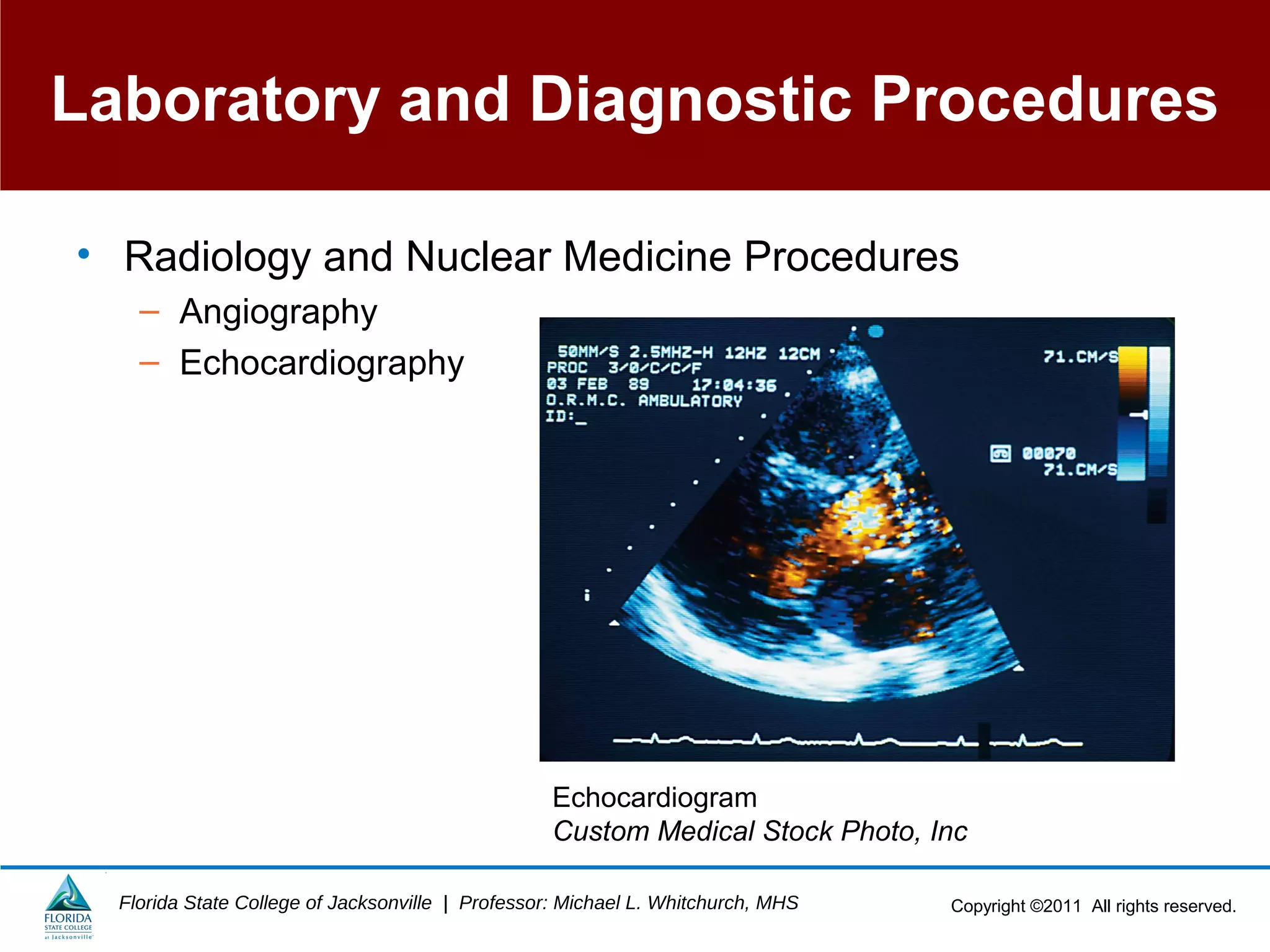Copyright ©2011 All rights reserved.Florida State College of Jacksonville | Professor: Michael L. Whitchurch, MHS
Laboratory and Diagnostic Procedures
• Radiology and Nuclear Medicine Procedures
– Angiography
– Echocardiography
Echocardiogram
Custom Medical Stock Photo, Inc
 