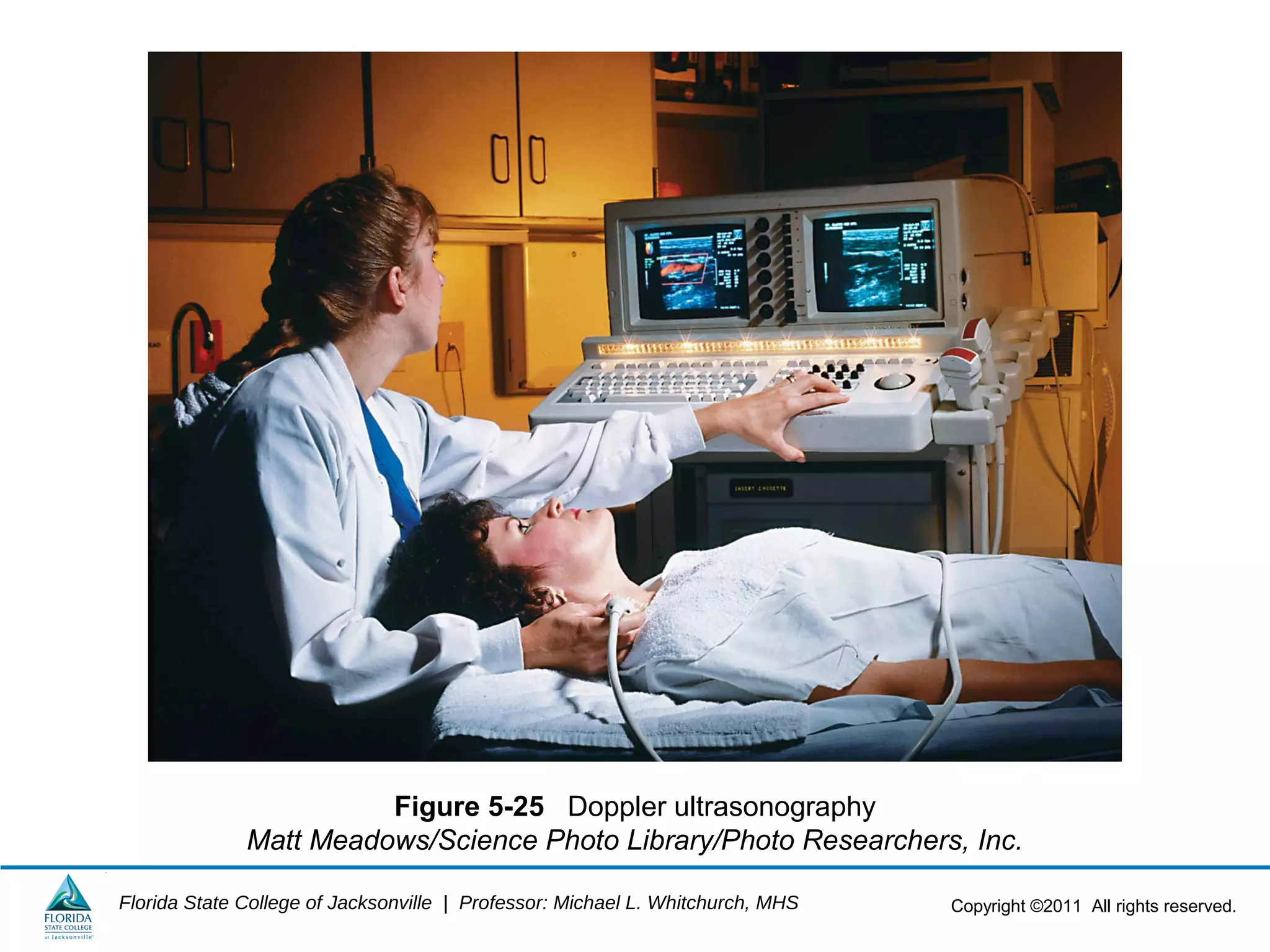 Copyright ©2011 All rights reserved.Florida State College of Jacksonville | Professor: Michael L. Whitchurch, MHS
Figure 5-25 Doppler ultrasonography
Matt Meadows/Science Photo Library/Photo Researchers, Inc.
 