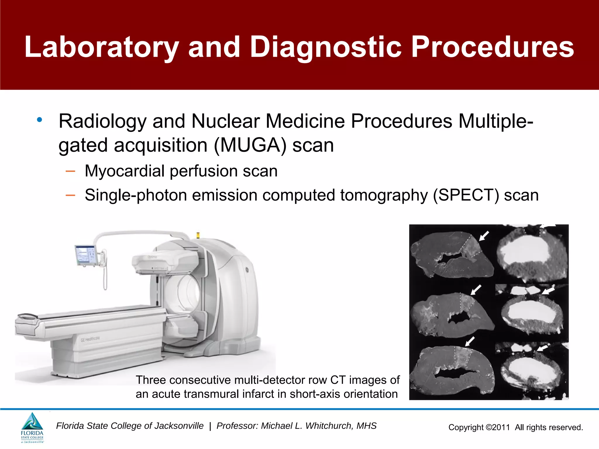 Copyright ©2011 All rights reserved.Florida State College of Jacksonville | Professor: Michael L. Whitchurch, MHS
Laboratory and Diagnostic Procedures
• Radiology and Nuclear Medicine Procedures Multiple-
gated acquisition (MUGA) scan
– Myocardial perfusion scan
– Single-photon emission computed tomography (SPECT) scan
Three consecutive multi-detector row CT images of
an acute transmural infarct in short-axis orientation
 