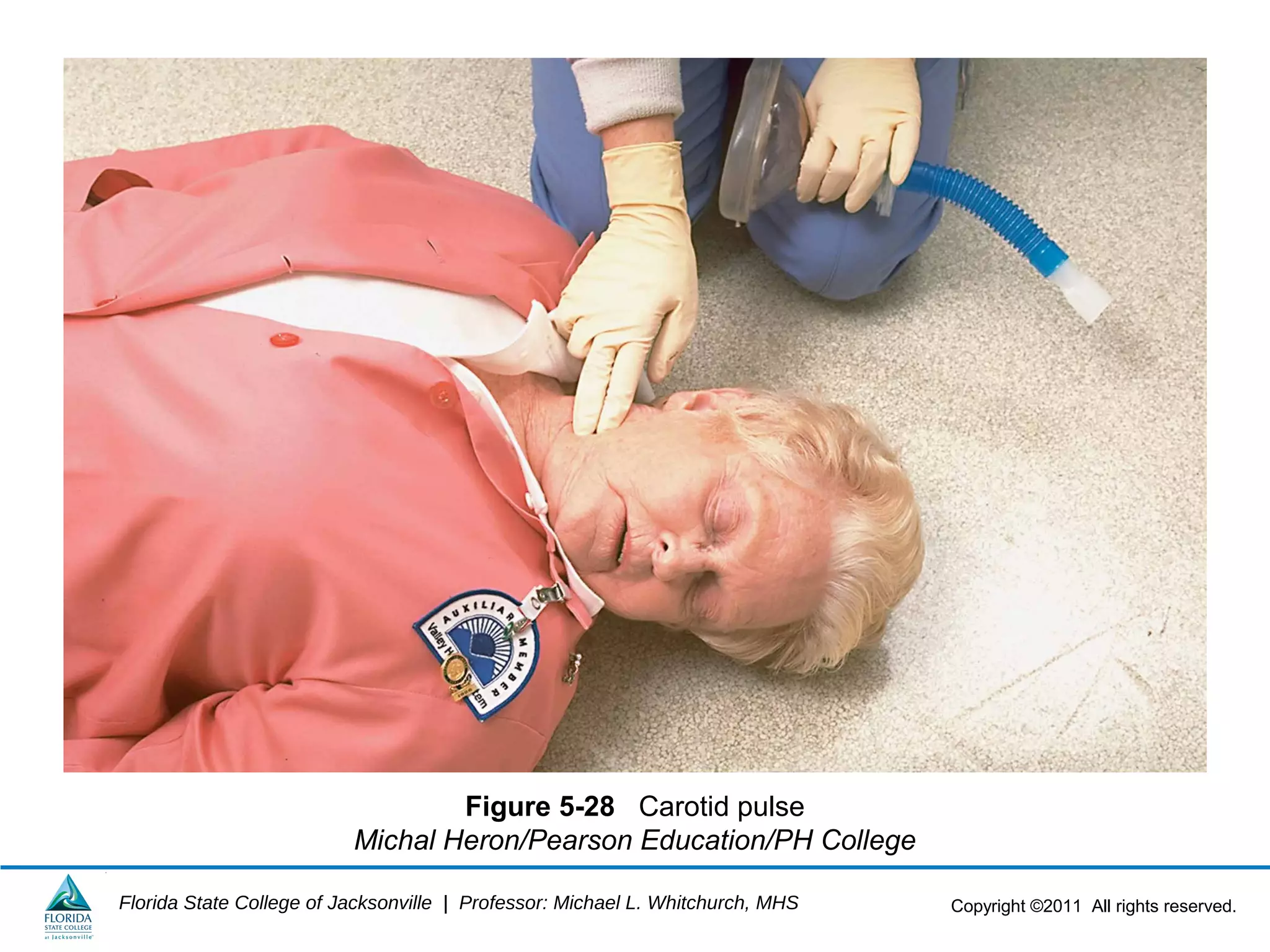 Copyright ©2011 All rights reserved.Florida State College of Jacksonville | Professor: Michael L. Whitchurch, MHS
Figure 5-28 Carotid pulse
Michal Heron/Pearson Education/PH College
 