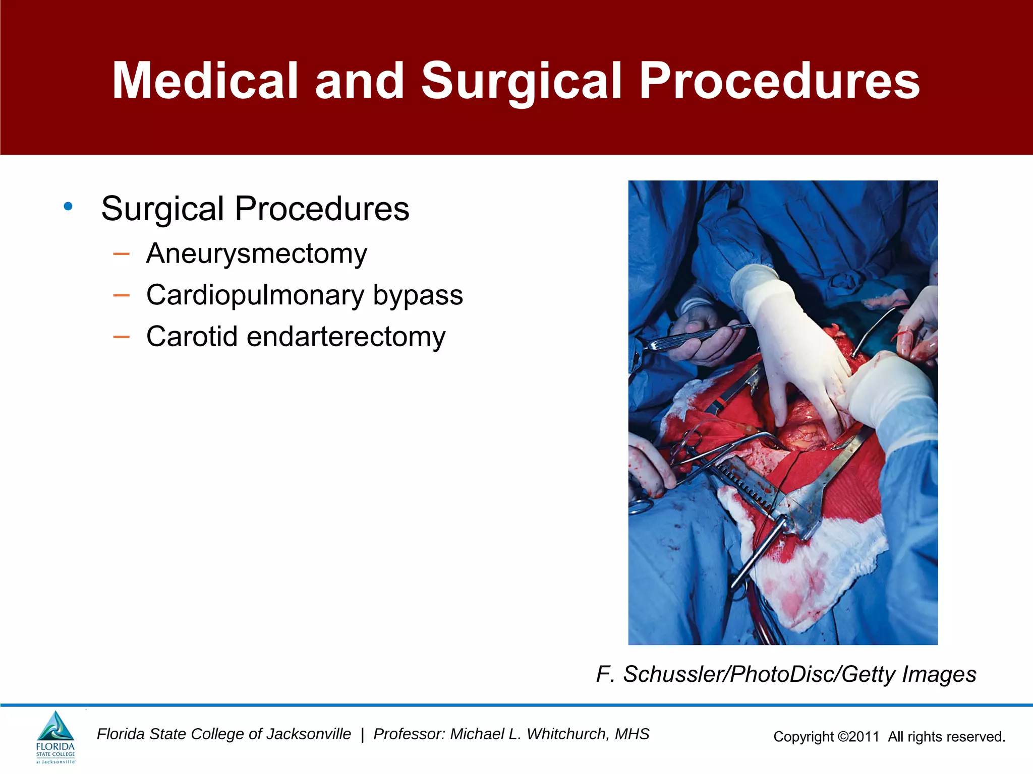 Copyright ©2011 All rights reserved.Florida State College of Jacksonville | Professor: Michael L. Whitchurch, MHS
Medical and Surgical Procedures
• Surgical Procedures
– Aneurysmectomy
– Cardiopulmonary bypass
– Carotid endarterectomy
F. Schussler/PhotoDisc/Getty Images
 