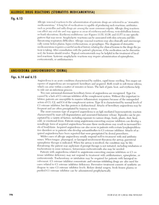 6/14 Allergies and immunologic diseases | PDF